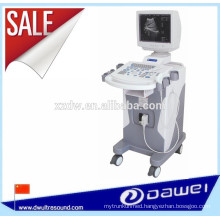 medical sonoscape ultrasound diagnostic equipment